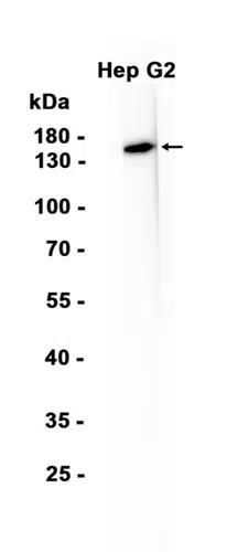 ENPP1 Rabbit Monoclonal Antibody - Size: 50µl