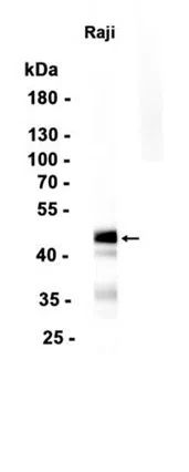 MEF2B Rabbit Monoclonal Antibody - Size: 50µl
