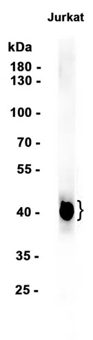 CD28 Rabbit Monoclonal Antibody - Size: 100µl