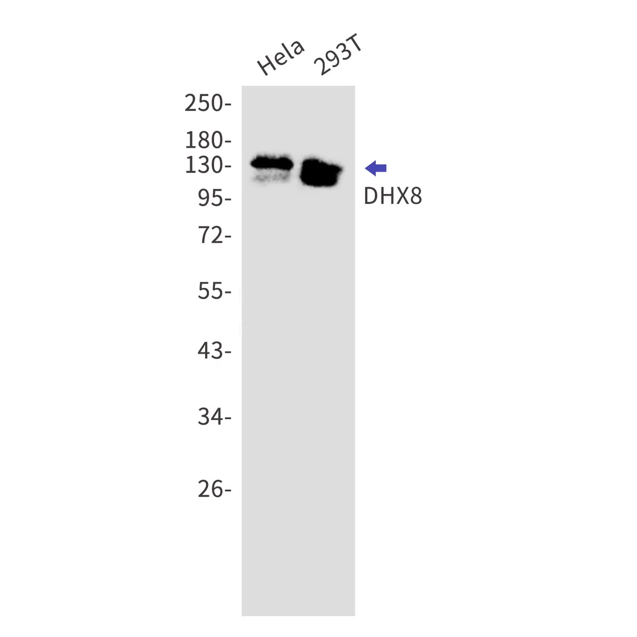 DHX8 Rabbit Monoclonal Antibody - Size: 50µl