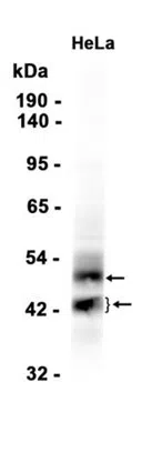 DR5 Rabbit Monoclonal Antibody - Size: 100µl