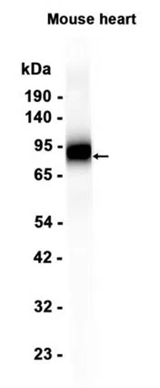 CD39 Rabbit Monoclonal Antibody - Size: 50µl