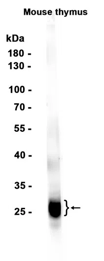 CD8B Rabbit Monoclonal Antibody - Size: 100µl