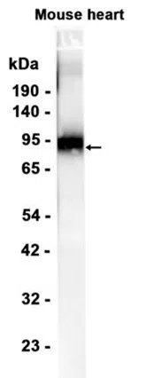 CD39 Rabbit Monoclonal Antibody - Size: 50µl