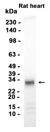 IGFBP5 Rabbit Monoclonal Antibody - Size: 50µl