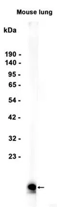 Sca1/Ly6A/E Rabbit Monoclonal Antibody