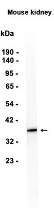 Arg2 Rabbit Monoclonal Antibody