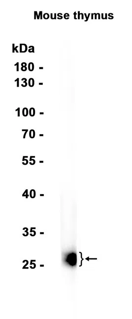 CD8B Rabbit Monoclonal Antibody - Size: 100µl