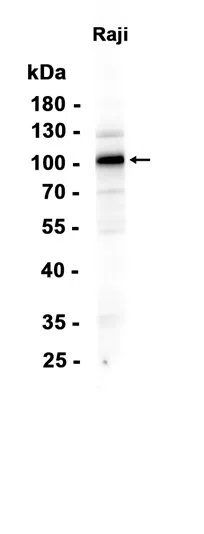 CD10 Rabbit Monoclonal Antibody - Size: 100µl