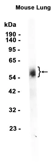 uPA Receptor/U-PAR Rabbit Monoclonal Antibody - Size: 100µl