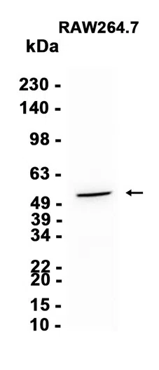 Phospho-AKT1 (Ser124) Rabbit Monoclonal Antibody - Size: 50µl