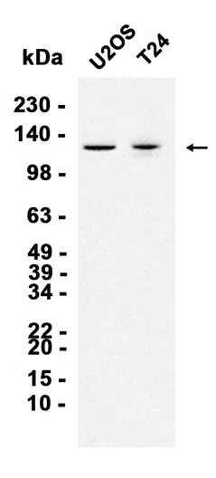 Phospho-ULK1 (Ser556) Rabbit Monoclonal Antibody - Size: 50µl