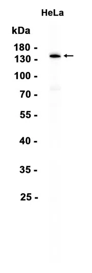 Phospho-Topoisomerase II alpha (Thr1343) Rabbit Monoclonal Antibody - Si