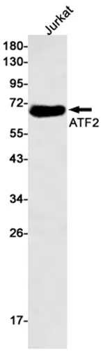 ATF2 Rabbit Monoclonal Antibody - Size: 100µl