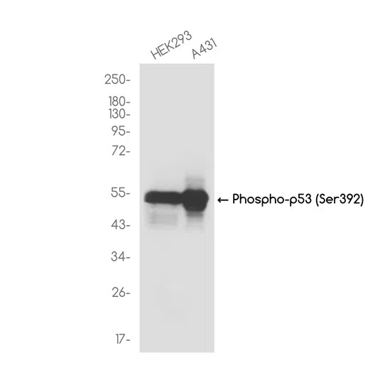 Phospho-p53 (Ser392) Rabbit Monoclonal Antibody - Size: 100µl