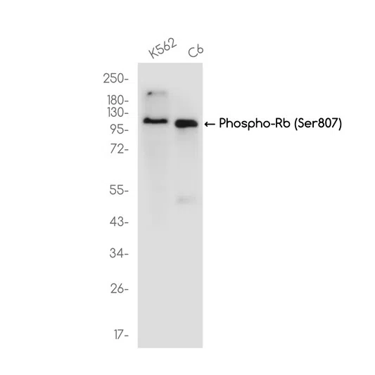 Phospho-Rb (Ser807) Rabbit Monoclonal Antibody - Size: 100µl
