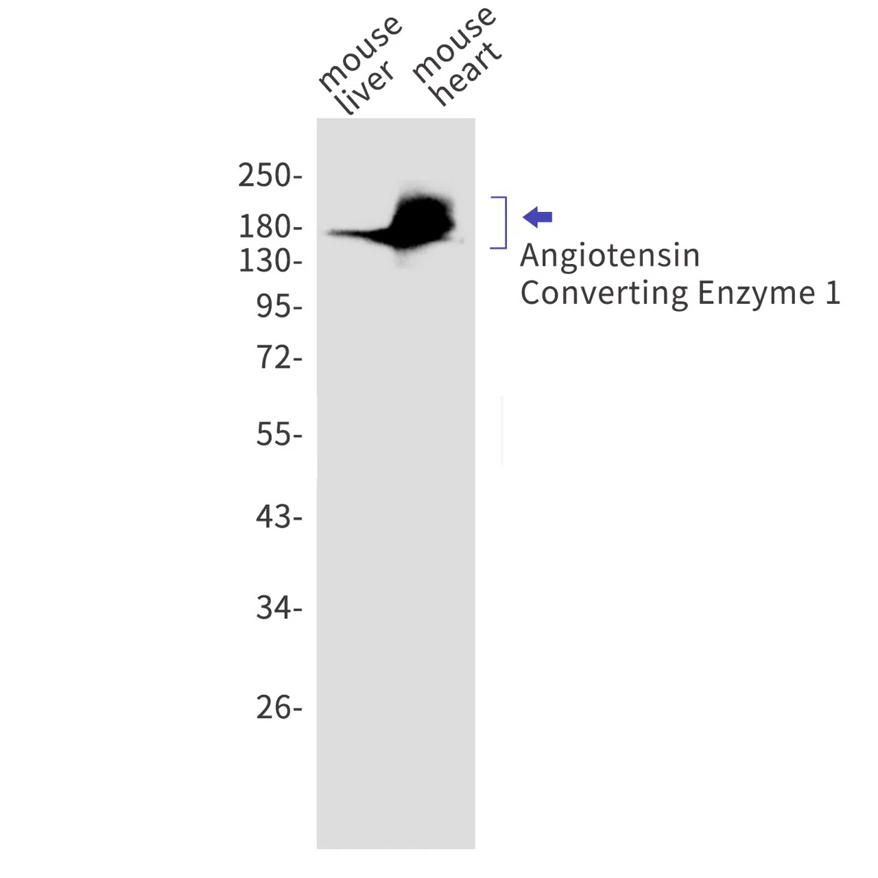 Angiotensin Converting Enzyme 1 Rabbit Monoclonal Antibody - Size: 50µl