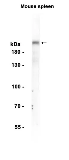 Integrin beta 4 Rabbit Monoclonal Antibody