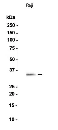 CD20 Rabbit Monoclonal Antibody - Size: 50µl