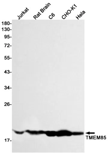 TMEM85 Rabbit Monoclonal Antibody - Size: 50µl