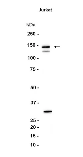 Lipin 1 Rabbit Monoclonal Antibody - Size: 100µl