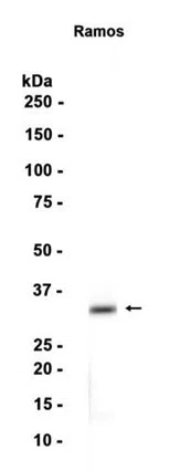 CD79b Rabbit Monoclonal Antibody