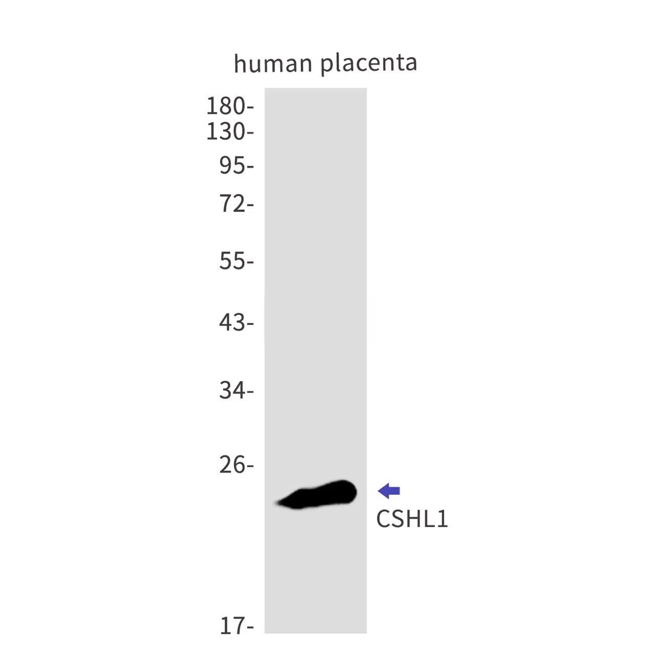 CSHL1 Rabbit Monoclonal Antibody - Size: 50µl