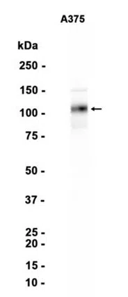 CD146 Rabbit Monoclonal Antibody - Size: 100µl