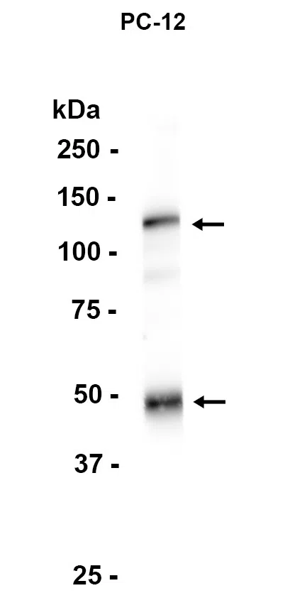 NFkB p105/p50 Rabbit Monoclonal Antibody - Size: 50µl