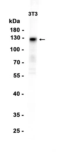 Ephrin receptor A2 Rabbit Monoclonal Antibody - Size: 50µl