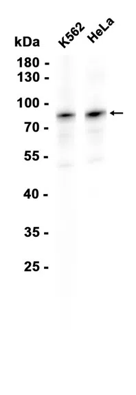 IRAK1 Rabbit Monoclonal Antibody - Size: 50µl
