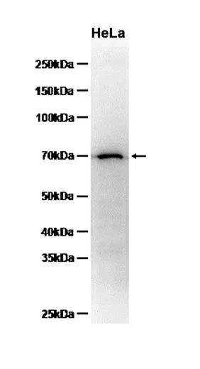 Phospho-NF-kB p65 (Ser536) Rabbit Monoclonal Antibody - Size: 50µl