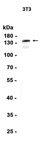BCR Rabbit Monoclonal Antibody - Size: 50µl