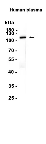 C5a Rabbit Monoclonal Antibody - Size: 100µl