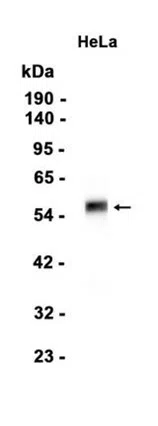 Cdk8 Rabbit Monoclonal Antibody