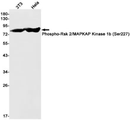 Phospho-Rsk 2/MAPKAP Kinase 1b (Ser227) Rabbit Monoclonal Antibody