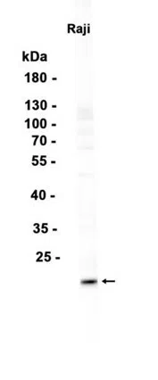 CMTM6 Rabbit Monoclonal Antibody - Size: 100µl