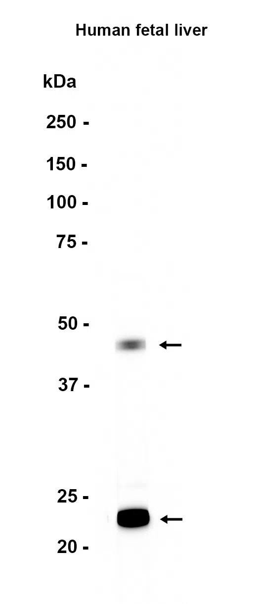 CPN1 Rabbit Monoclonal Antibody