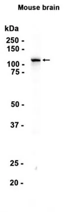 DHX36 Rabbit Monoclonal Antibody
