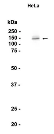 FANCI Rabbit Monoclonal Antibody - Size: 50µl