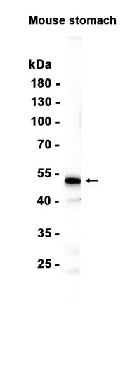 GSDMC Rabbit Monoclonal Antibody - Size: 100µl