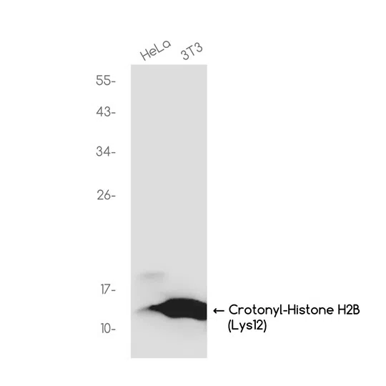Crotonyl-Histone H2B (Lys12) Rabbit Monoclonal Antibody - Size: 100µl