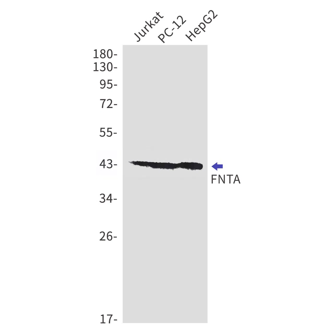 FNTA Rabbit Monoclonal Antibody - Size: 100µl
