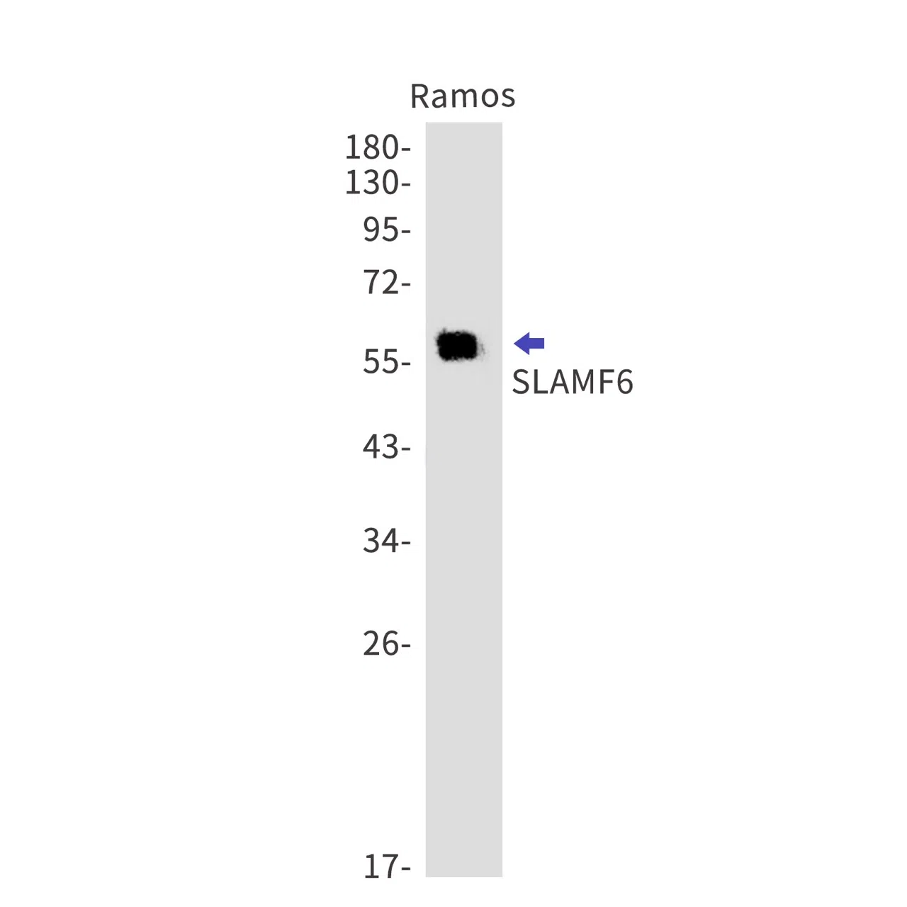 SLAMF6 Rabbit Monoclonal Antibody - Size: 100µl