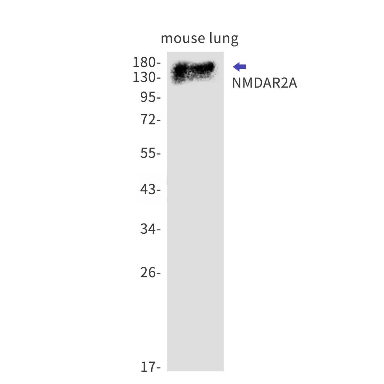 NMDAR2A Rabbit Monoclonal Antibody - Size: 50µl