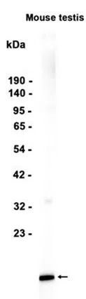 ID4 Rabbit Monoclonal Antibody