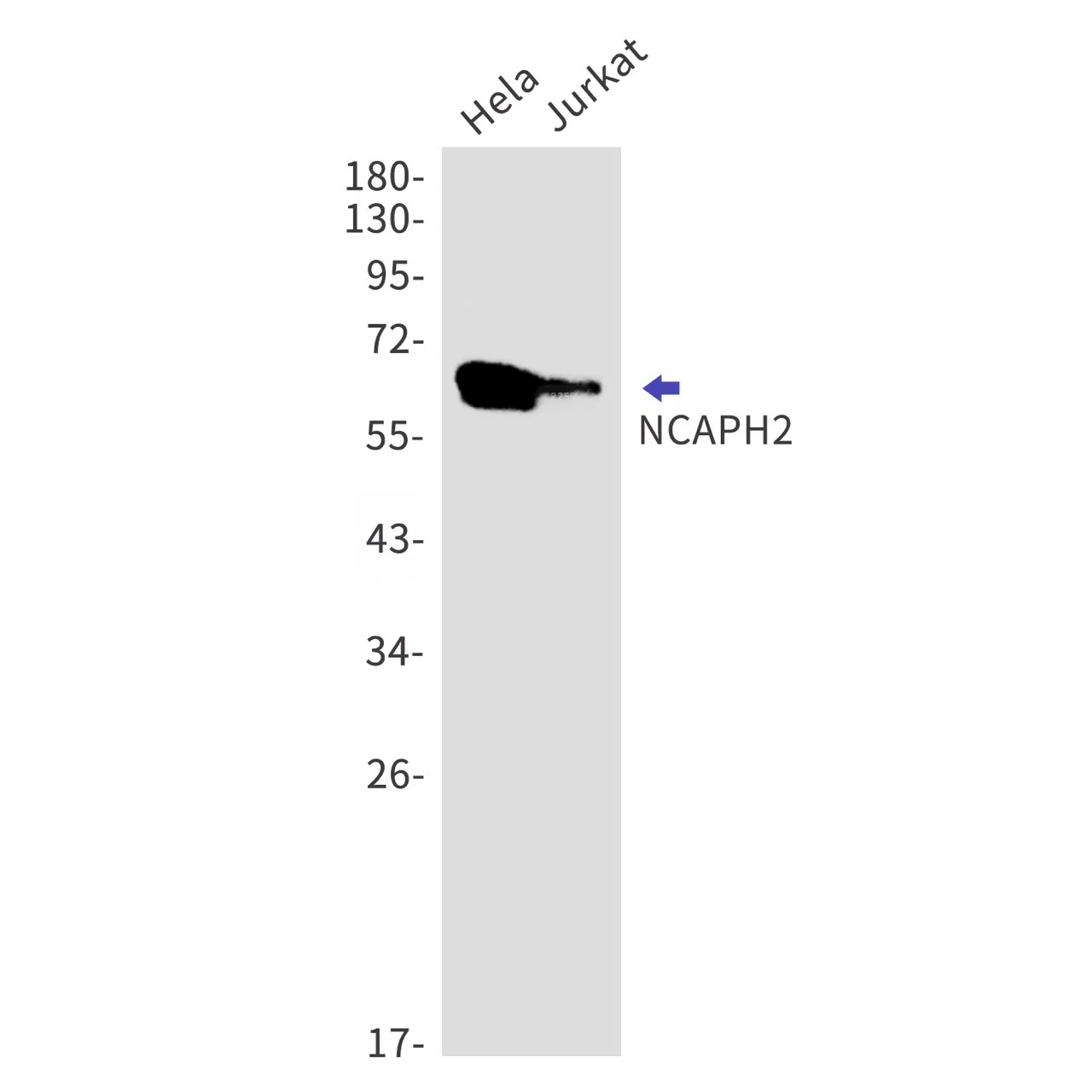NCAPH2 Rabbit Monoclonal Antibody - Size: 50µl