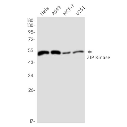 DAP kinase 3 Rabbit Monoclonal Antibody - Size: 100µl