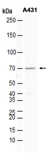 GRK6 Rabbit Monoclonal Antibody - Size: 100µl