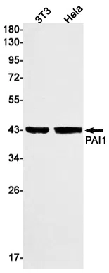 PAI1 Rabbit Monoclonal Antibody - Size: 100µl
